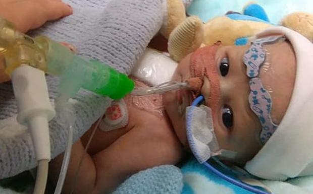 El desesperado S.0.S de una madre para que su bebé de 5 semanas pueda sobrevivir