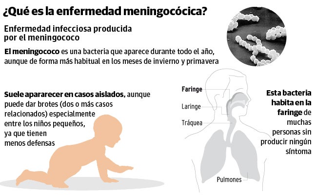 Los S Ntomas De La Meningitis En Ni Os Y Adultos Ideal