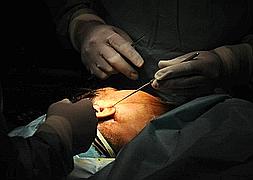 Las clínicas privadas deberán informar de la cirugía estética que practiquen a menores